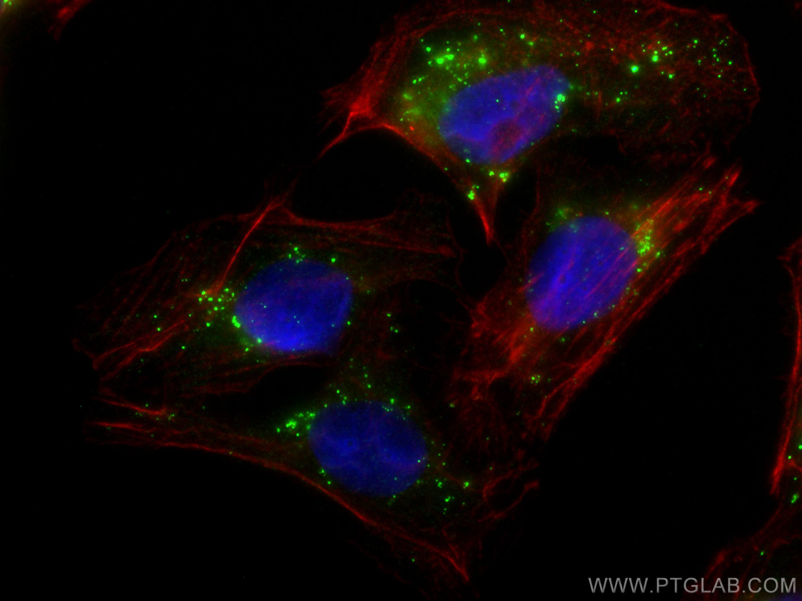 Immunofluorescence (IF) / fluorescent staining of U2OS cells using P62,SQSTM1 Monoclonal antibody (66184-1-Ig)