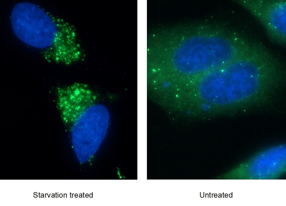 Immunofluorescence (IF) / fluorescent staining of HepG2 cells using P62,SQSTM1 Monoclonal antibody (66184-1-Ig)