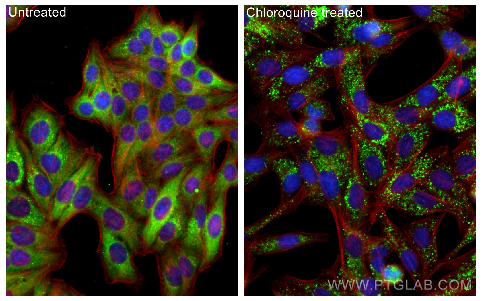 Immunofluorescence (IF) / fluorescent staining of HepG2 cells using P62/SQSTM1 Monoclonal antibody (66184-1-Ig)