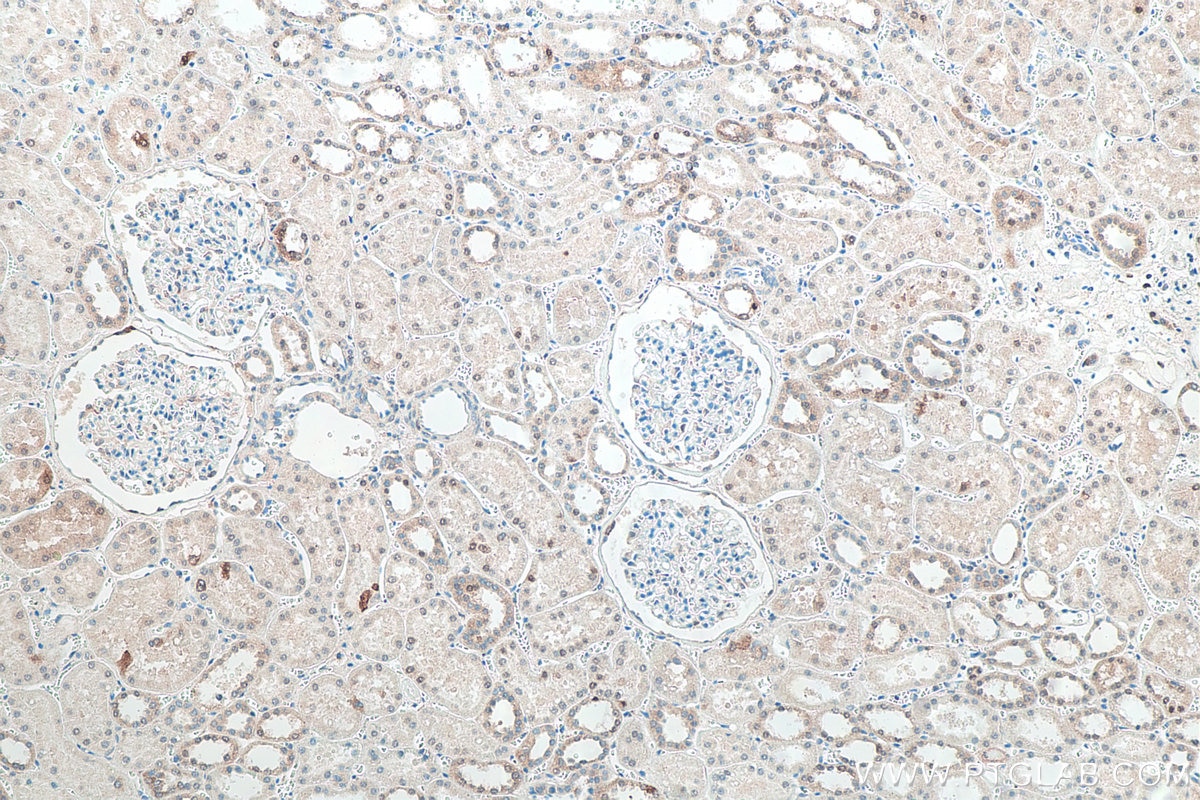 IHC staining of human kidney using 66184-1-Ig Immunohistochemistry (IHC) staining of human kidney tissue using P62/SQSTM1 Monoclonal antibody (66184-1-Ig)
