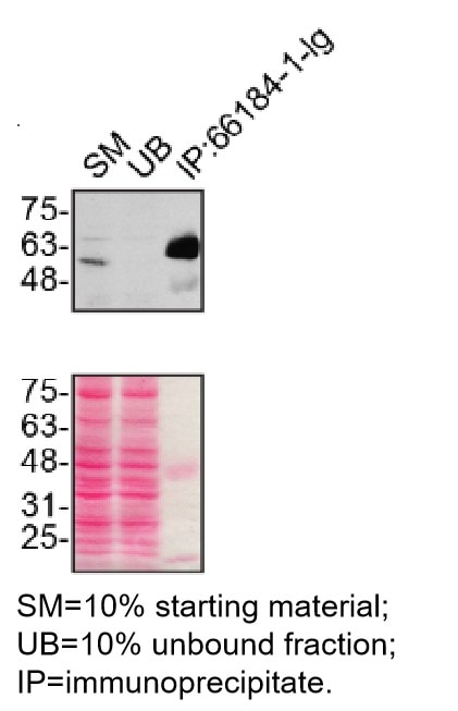 Immunoprecipitation (IP) experiment of U2OS cells using P62,SQSTM1 Monoclonal antibody (66184-1-Ig)