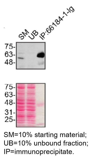 IP experiment of U2OS using 66184-1-Ig