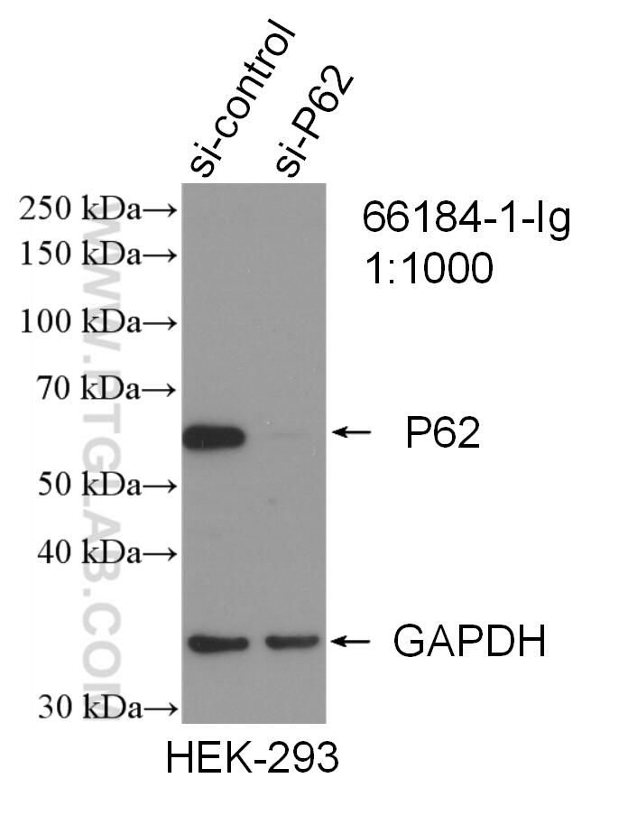 Western Blot (WB) analysis of HEK-293 cells using P62,SQSTM1 Monoclonal antibody (66184-1-Ig)