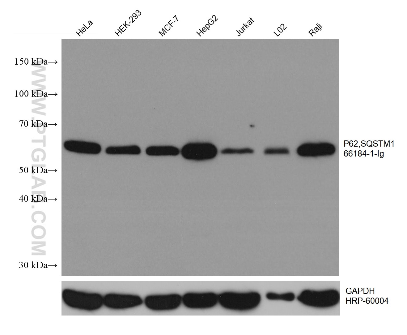 P62,SQSTM1 antibody (66184-1-Ig) Proteintech