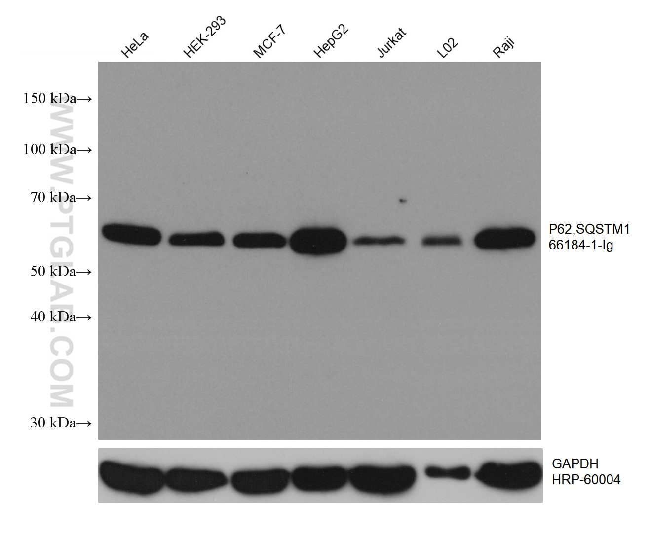 WB analysis using 66184-1-Ig