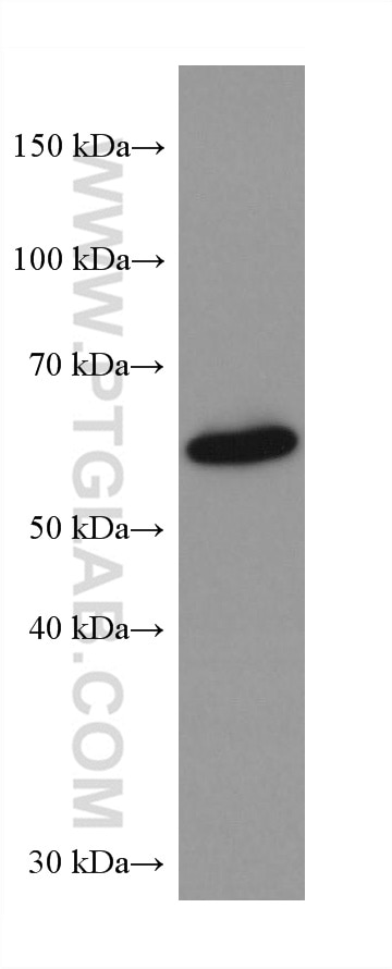 Western Blot (WB) analysis of K-562 cells using P62,SQSTM1 Monoclonal antibody (66184-1-Ig)