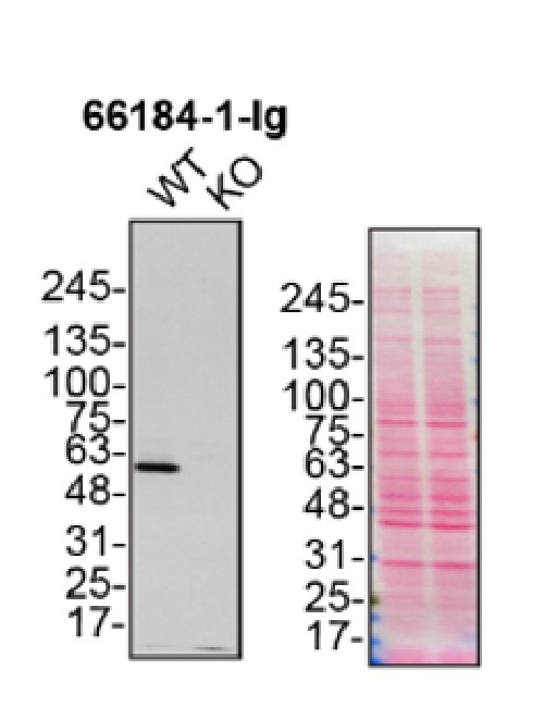Western Blot (WB) analysis of U2OS cells using P62,SQSTM1 Monoclonal antibody (66184-1-Ig)
