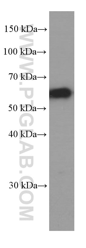 P62,SQSTM1 Monoclonal antibody