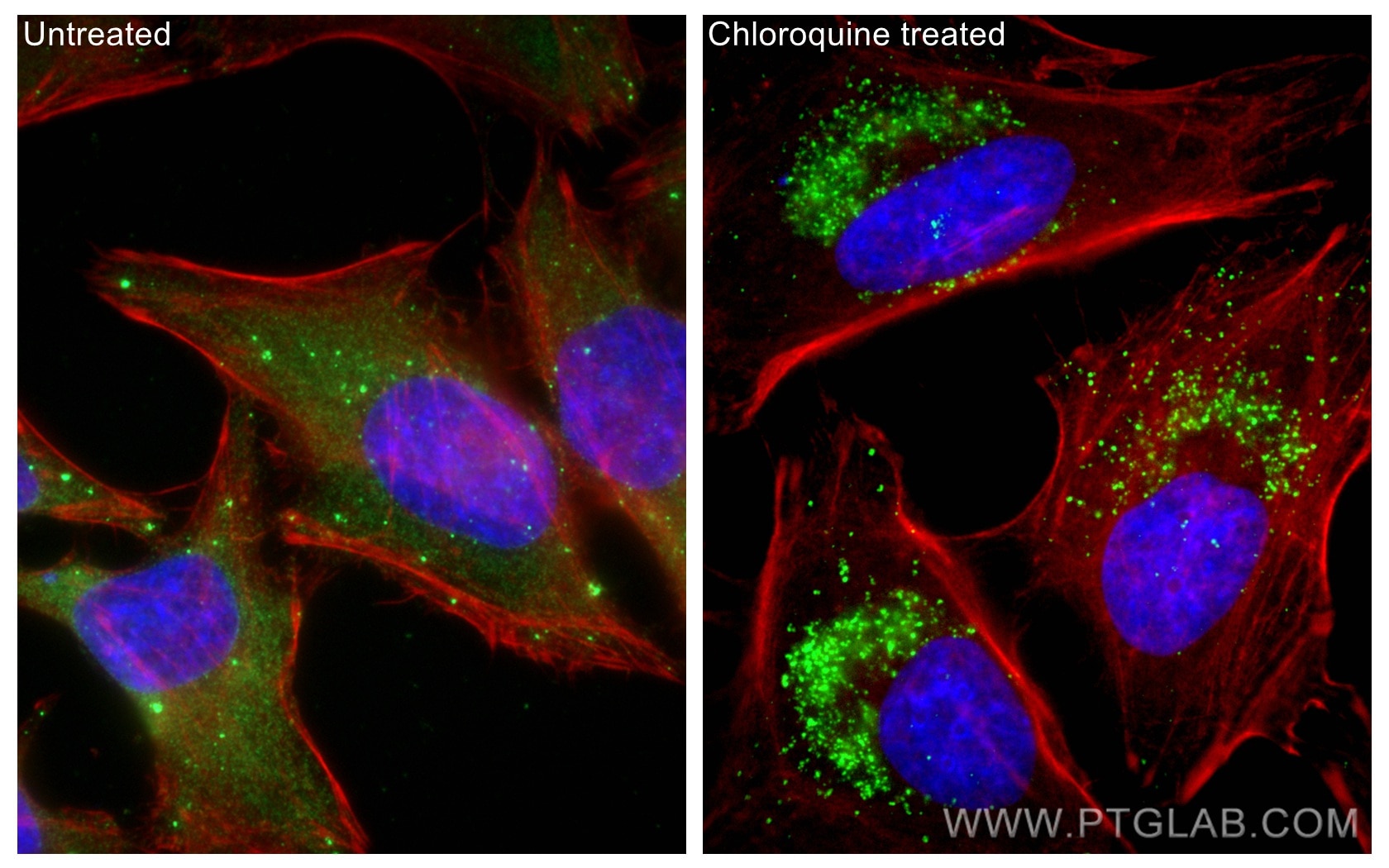 Immunofluorescence (IF) / fluorescent staining of HeLa cells using P62,SQSTM1 Recombinant antibody (80294-1-RR)