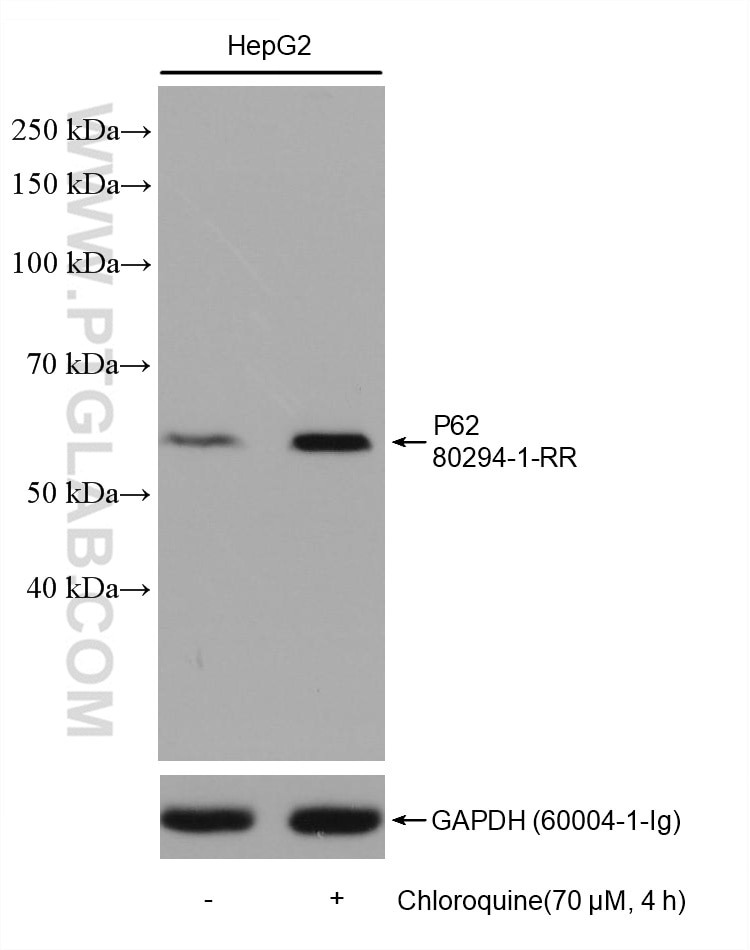 Western Blot (WB) analysis of various lysates using P62,SQSTM1 Recombinant antibody (80294-1-RR)