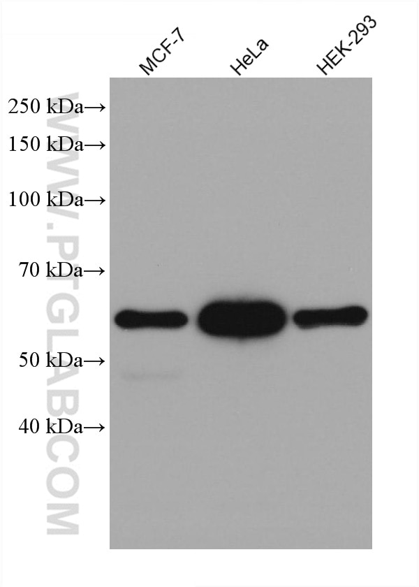 Western Blot (WB) analysis of various lysates using P62,SQSTM1 Recombinant antibody (80294-1-RR)