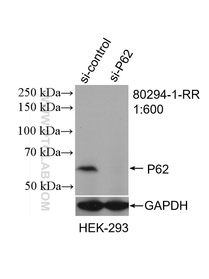 Western Blot (WB) analysis of HEK-293 cells using P62,SQSTM1 Recombinant antibody (80294-1-RR)