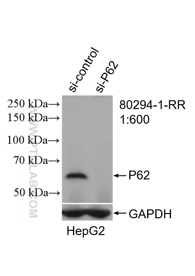 Western Blot (WB) analysis of HepG2 cells using P62,SQSTM1 Recombinant antibody (80294-1-RR)