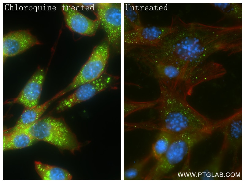 Immunofluorescence (IF) / fluorescent staining of NIH/3T3 cells using P62/SQSTM1 Recombinant antibody (84826-1-RR)