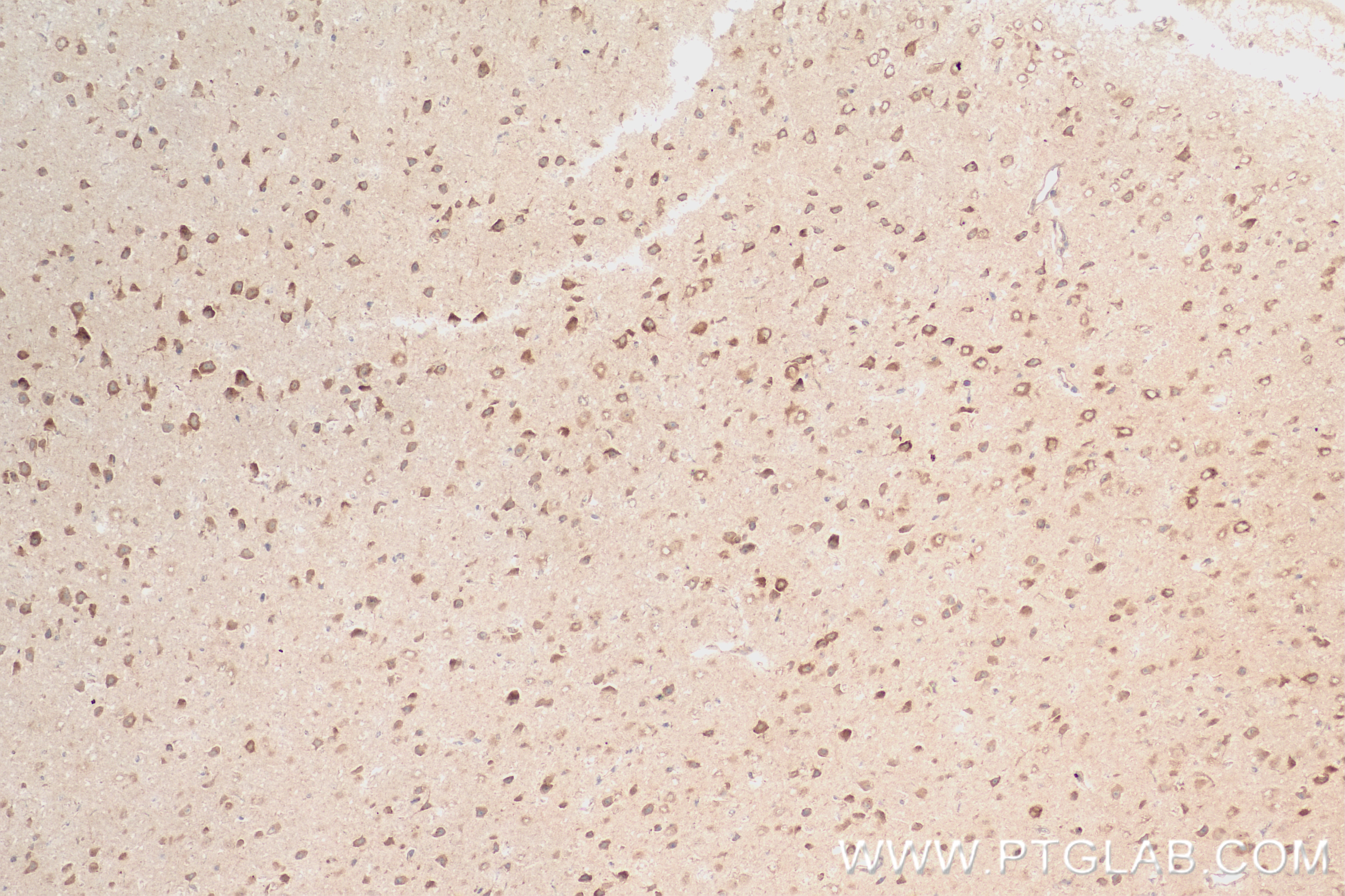 Immunohistochemistry (IHC) staining of mouse brain tissue using P62/SQSTM1 Recombinant antibody (84826-1-RR)