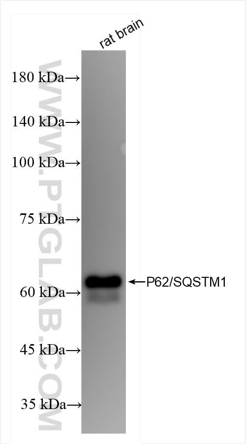 P62/SQSTM1