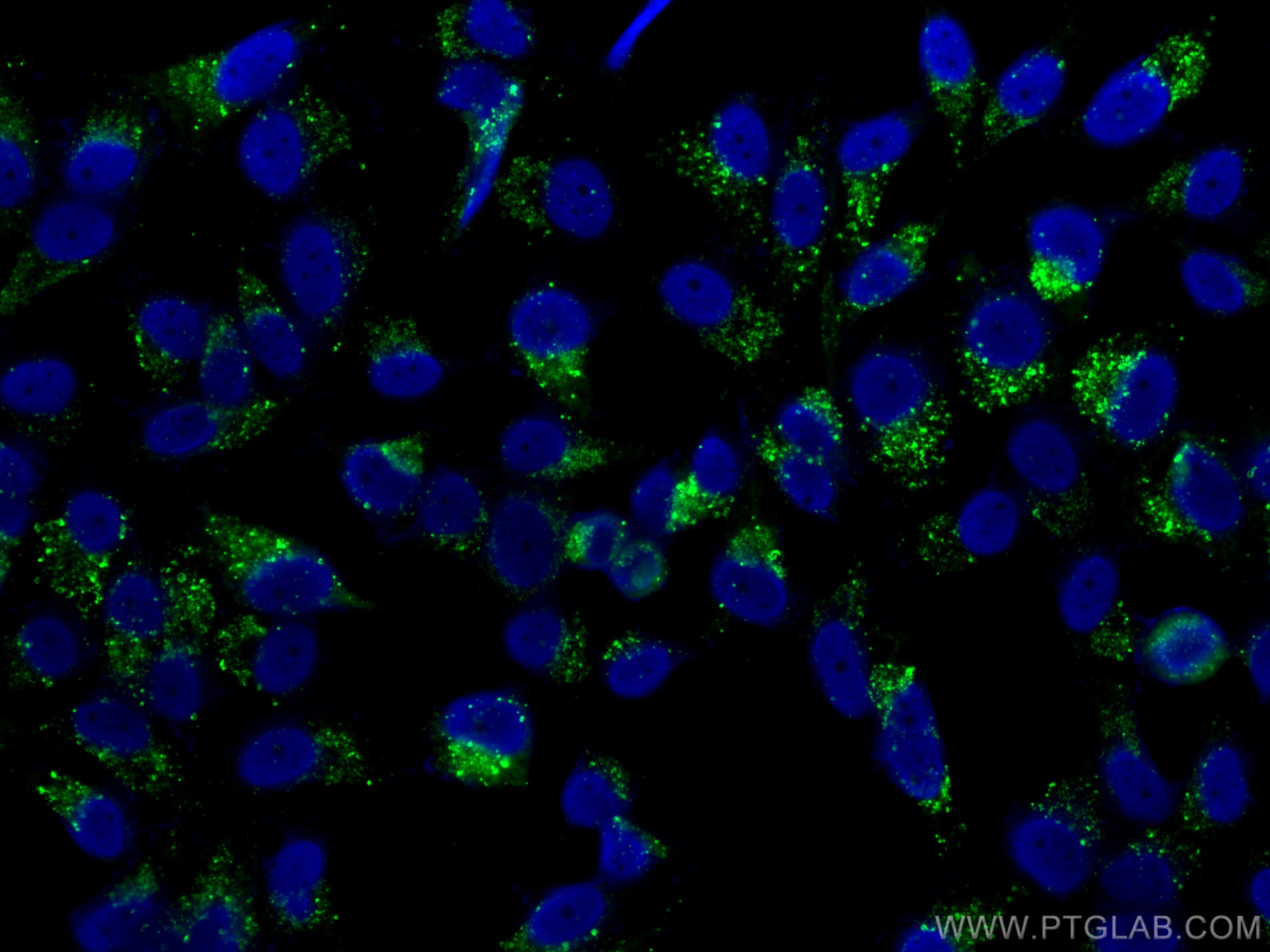 Immunofluorescence (IF) / fluorescent staining of HepG2 cells using CoraLite® Plus 488-conjugated P62,SQSTM1 Monoclona (CL488-66184)