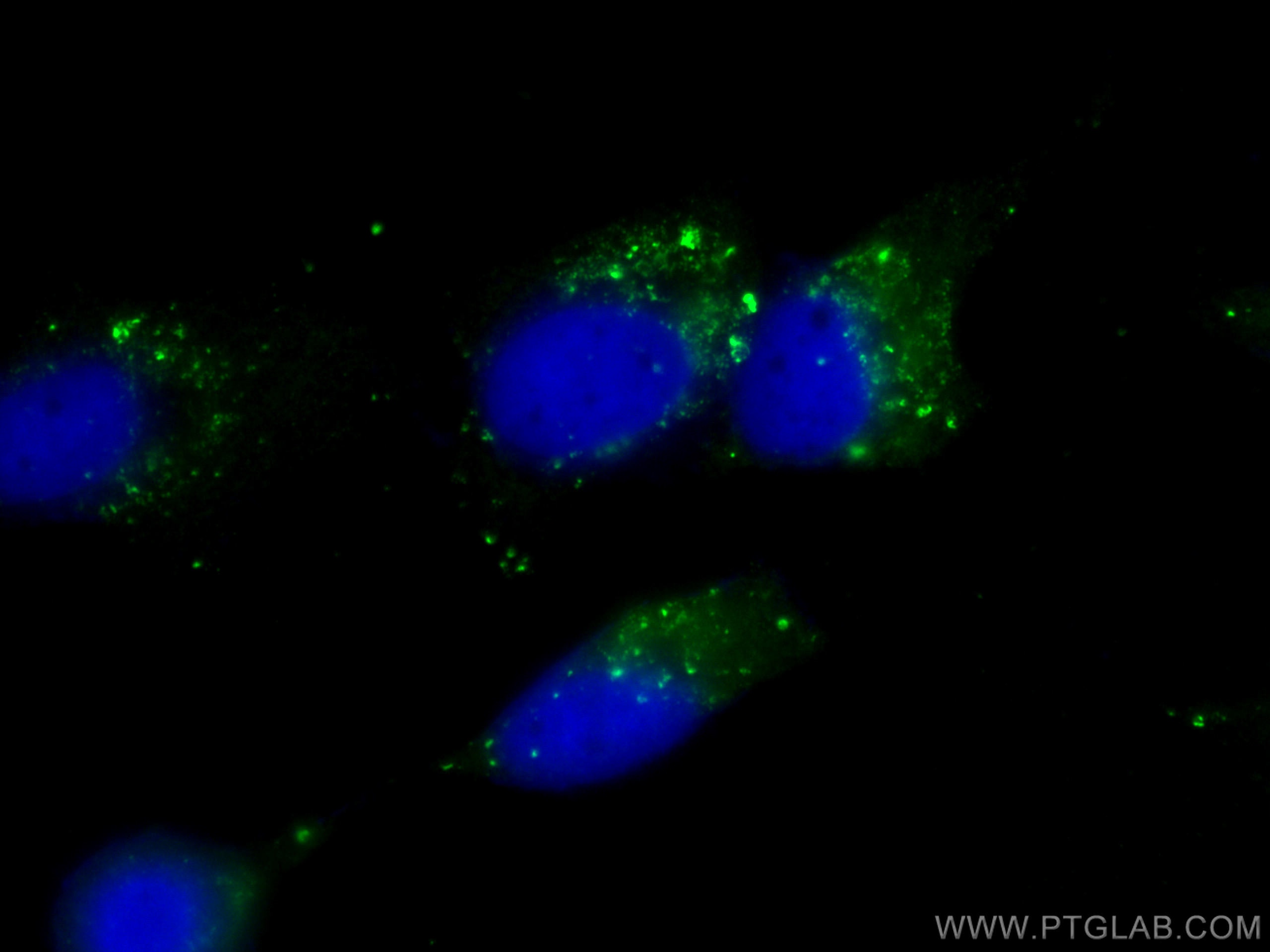 Immunofluorescence (IF) / fluorescent staining of HepG2 cells using CoraLite® Plus 488-conjugated P62,SQSTM1 Monoclona (CL488-66184)