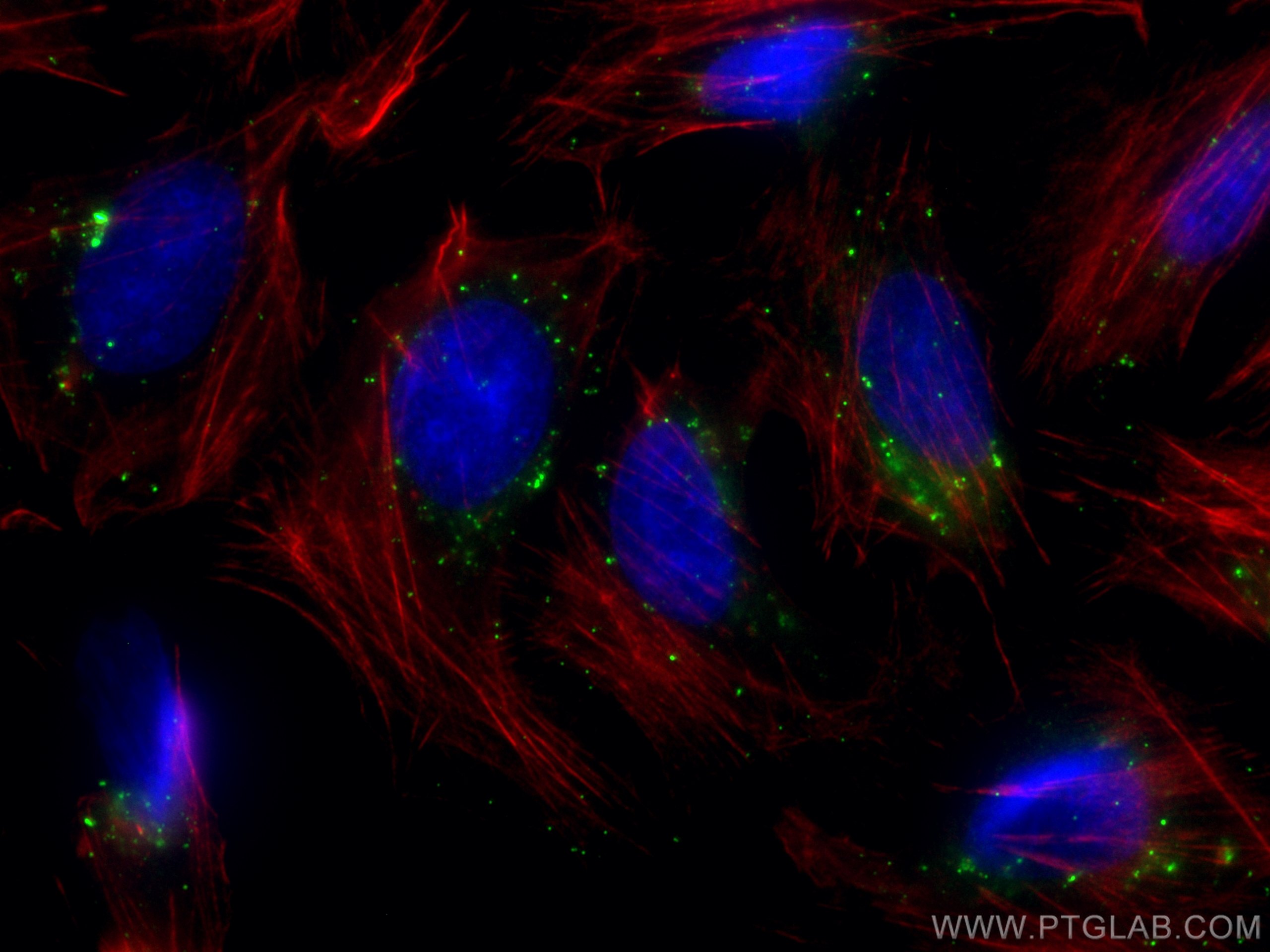 Immunofluorescence (IF) / fluorescent staining of U2OS cells using CoraLite® Plus 488-conjugated P62,SQSTM1 Monoclona (CL488-66184)