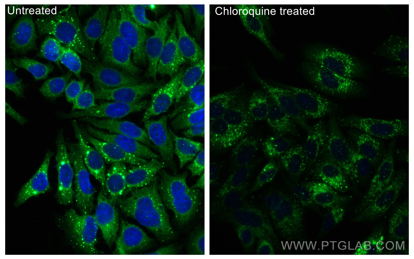 Immunofluorescence (IF) / fluorescent staining of HepG2 cells using CoraLite® Plus 488-conjugated P62,SQSTM1 Recombina (CL488-80294)