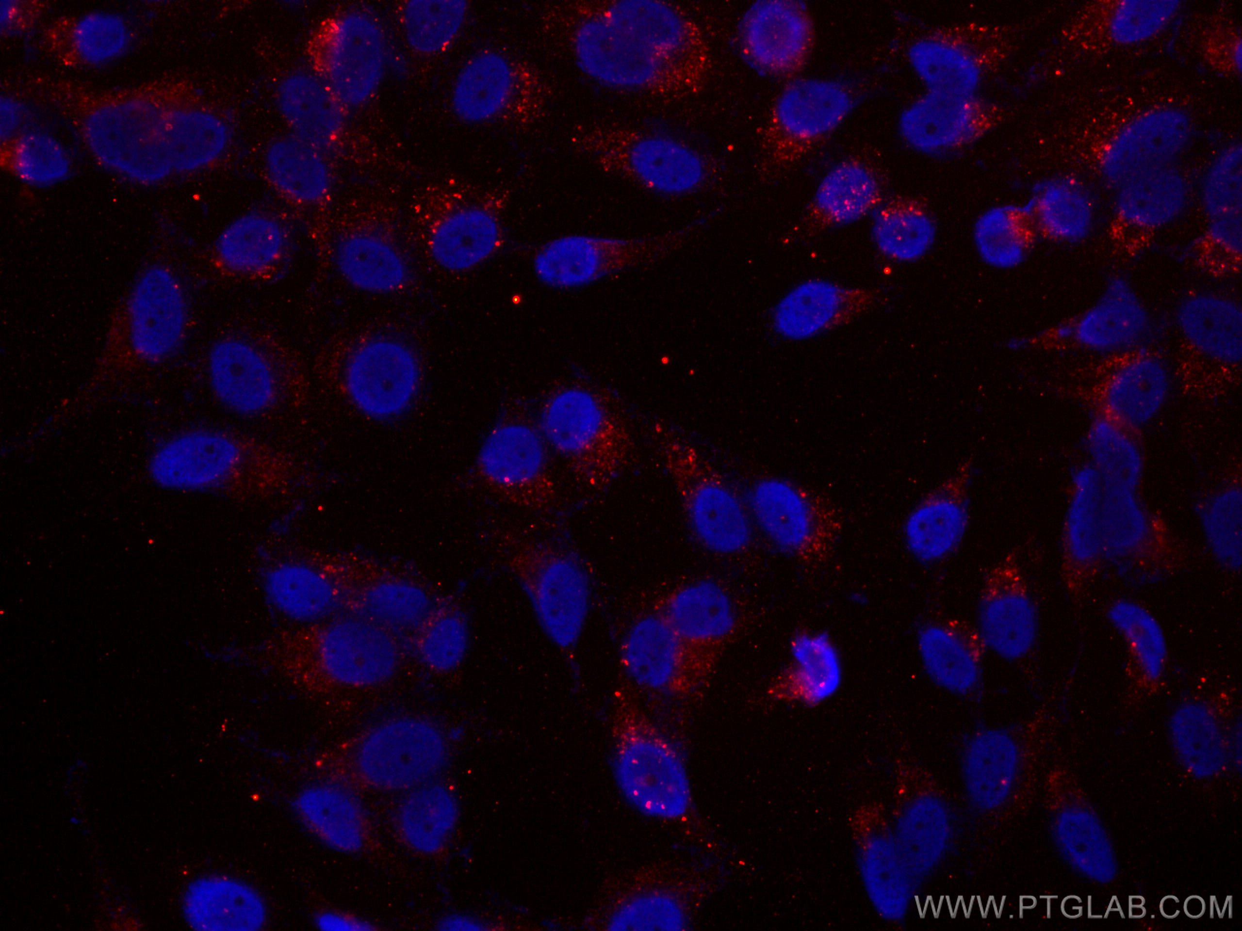 Immunofluorescence (IF) / fluorescent staining of HepG2 cells using CoraLite®594-conjugated P62,SQSTM1 Monoclonal anti (CL594-66184)