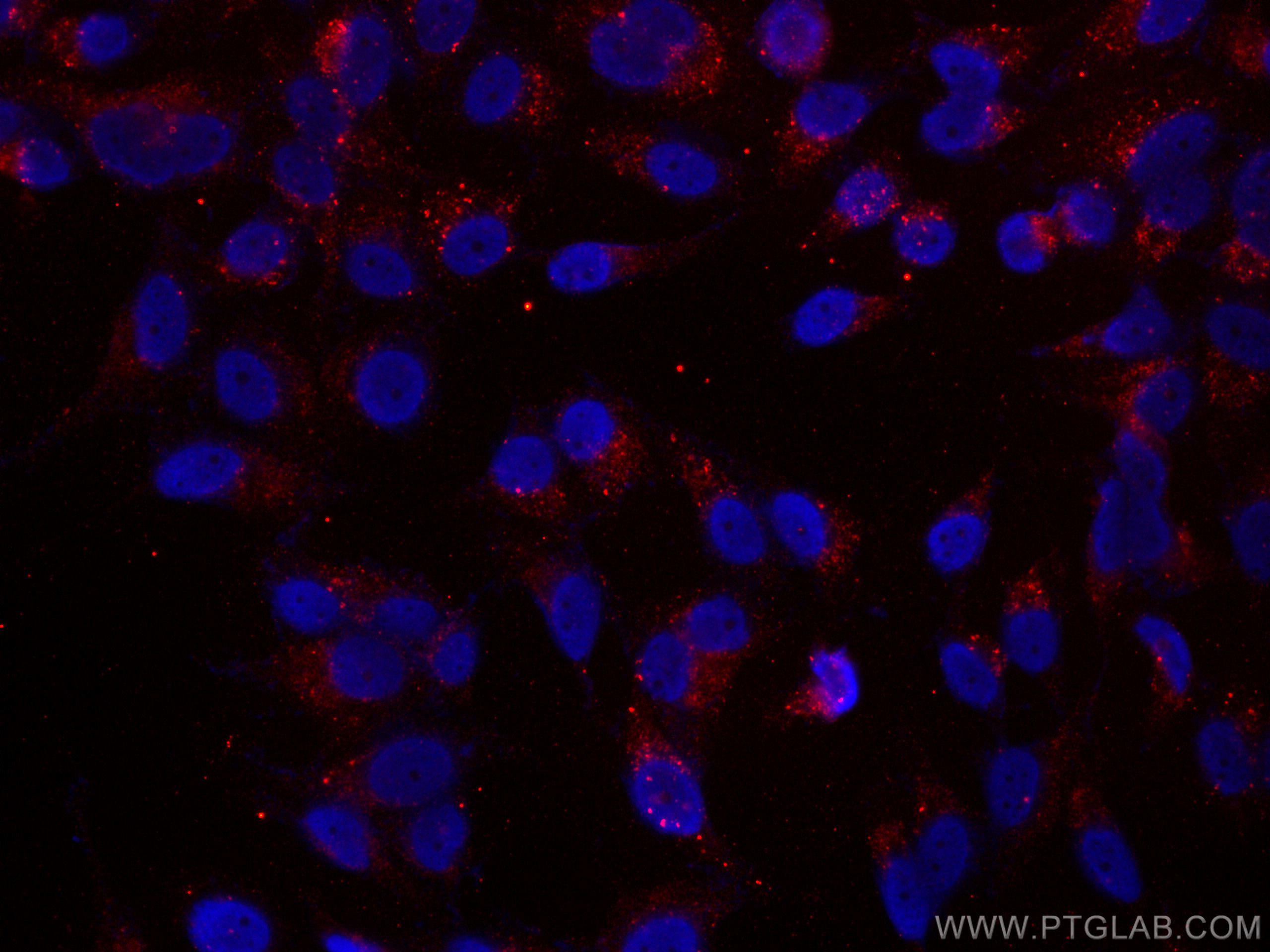 IF Staining of HepG2 using CL594-66184