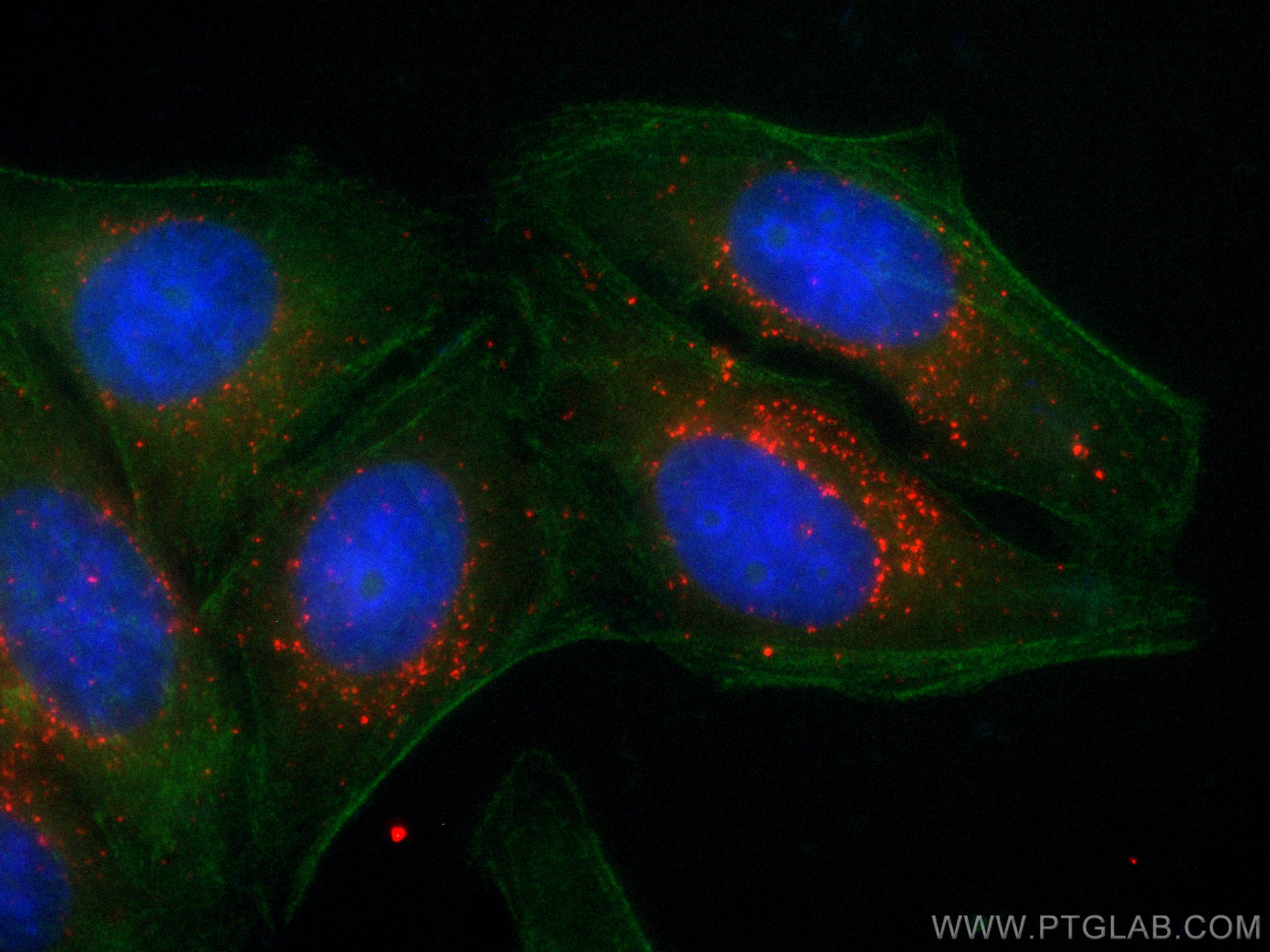 Immunofluorescence (IF) / fluorescent staining of HepG2 cells using CoraLite®594-conjugated P62,SQSTM1 Monoclonal anti (CL594-66184)