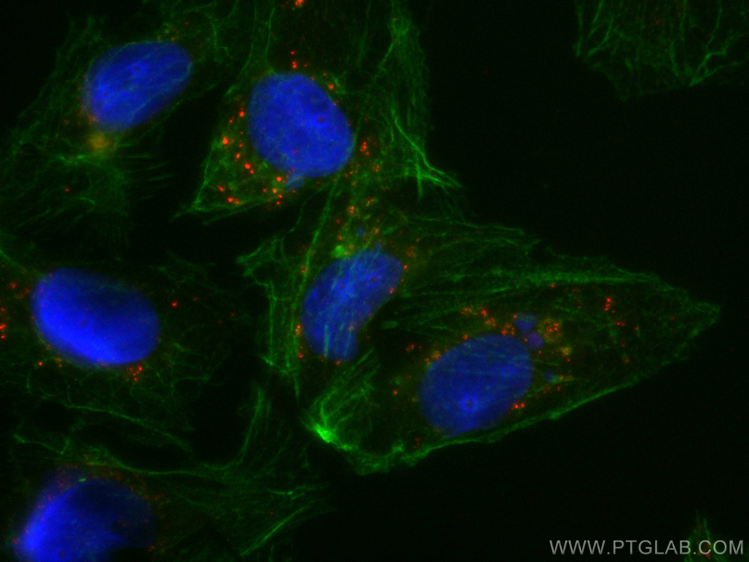 Immunofluorescence (IF) / fluorescent staining of U2OS cells using CoraLite®594-conjugated P62,SQSTM1 Monoclonal anti (CL594-66184)