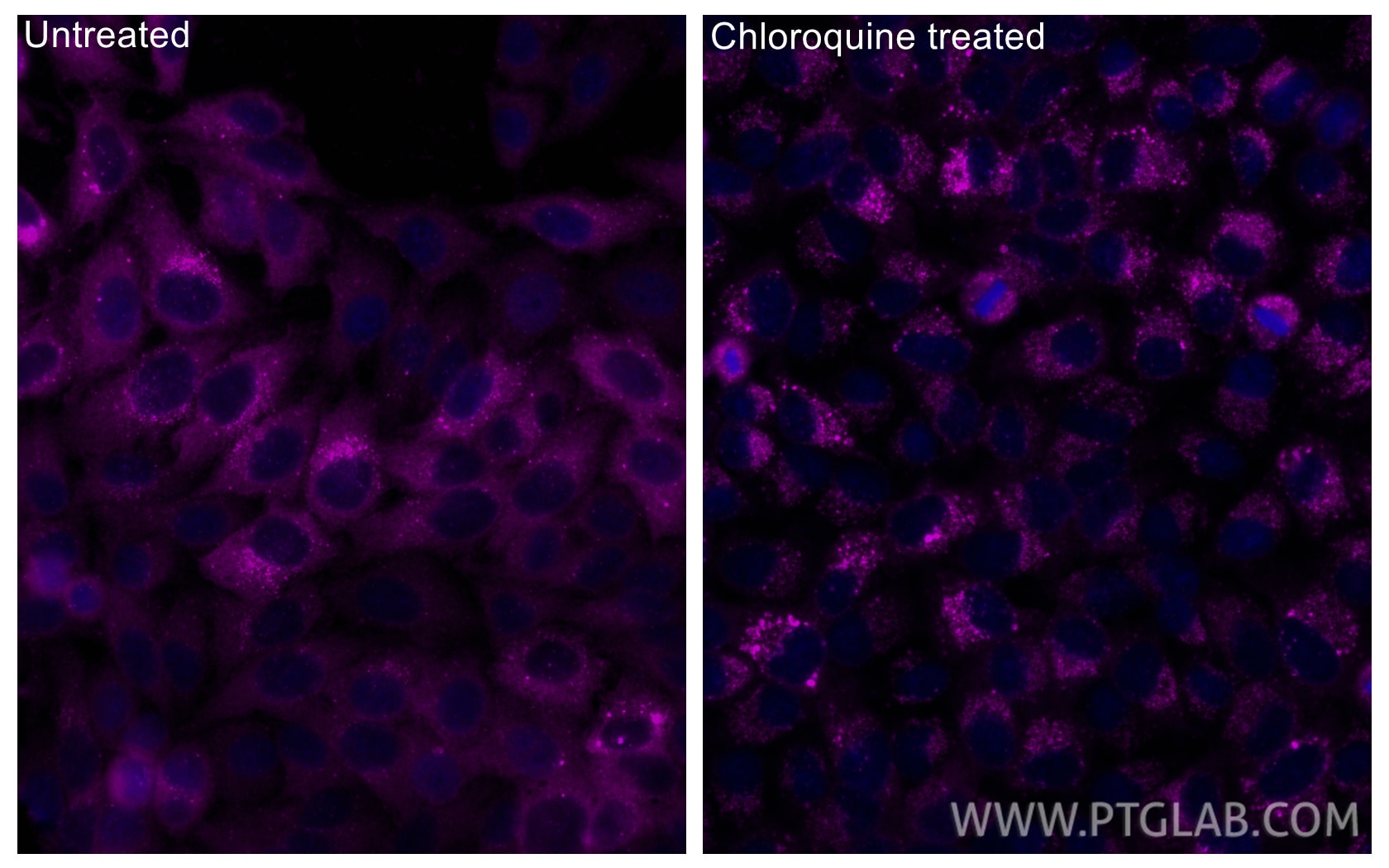 Immunofluorescence (IF) / fluorescent staining of HepG2 cells using CoraLite® Plus 647-conjugated P62/SQSTM1 Polyclona (CL647-18420)