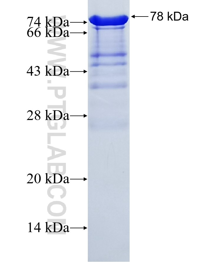 P62;SQSTM1 fusion protein Ag13131 SDS-PAGE