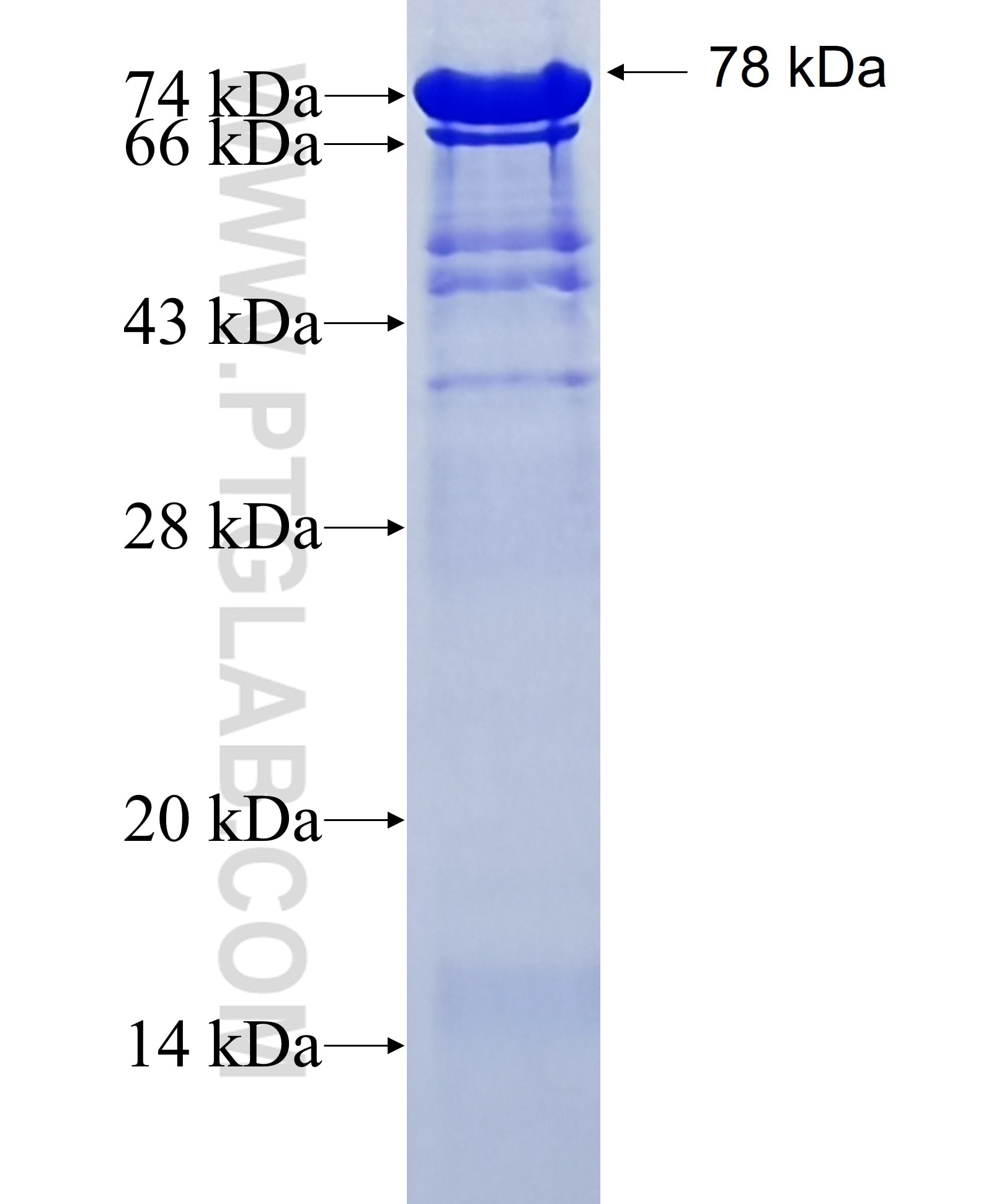 P62;SQSTM1 fusion protein Ag13131 SDS-PAGE