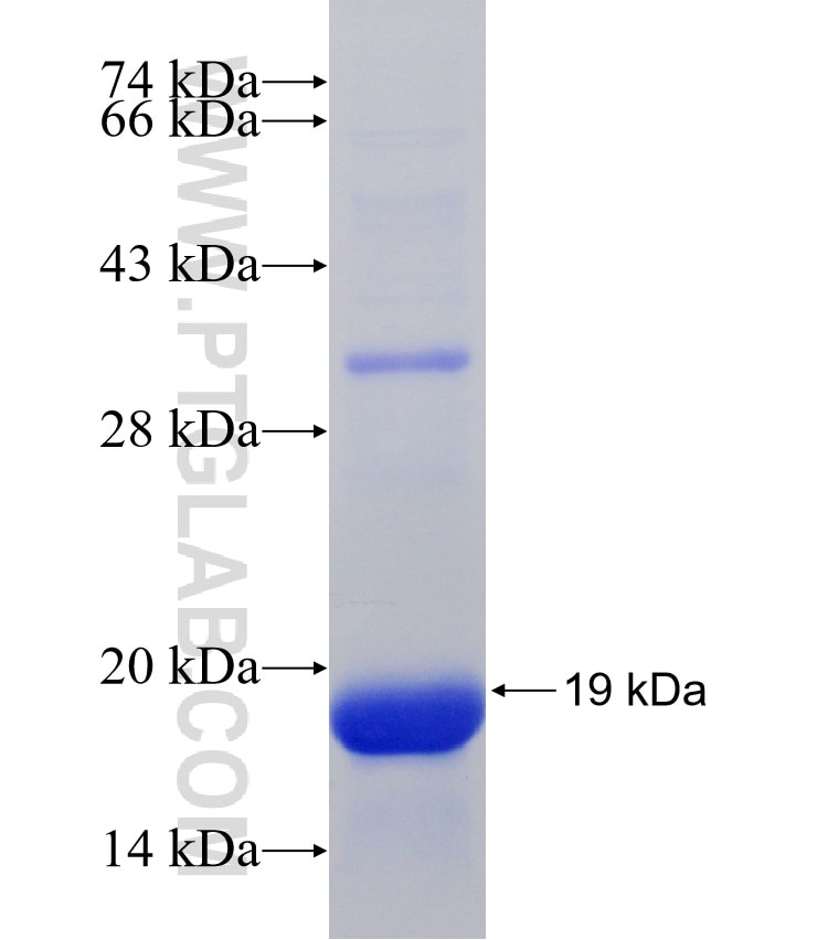P72 of ASFV fusion protein Ag31445 SDS-PAGE