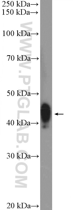 WB analysis of rat spleen using 15348-1-AP