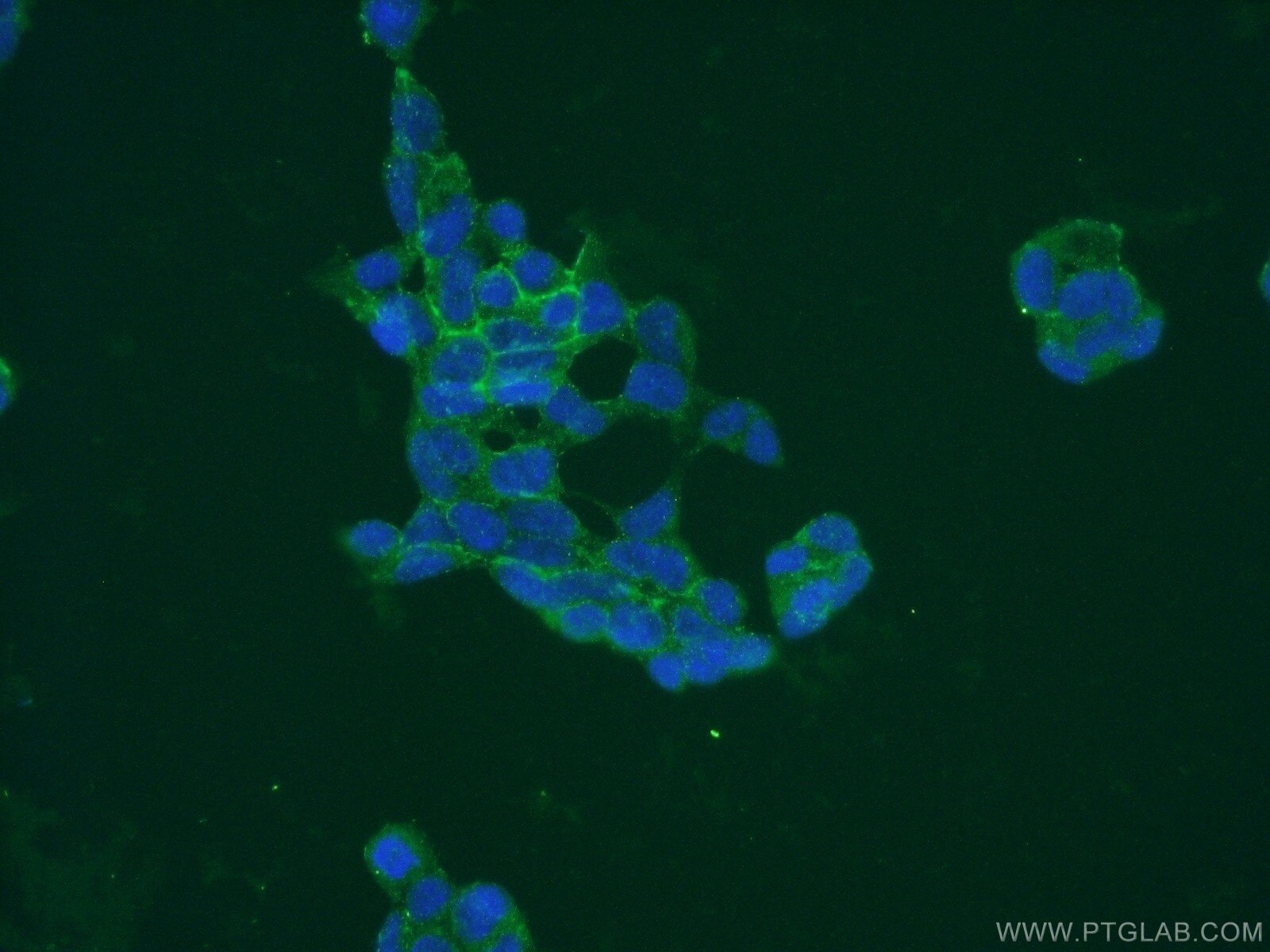 Immunofluorescence (IF) / fluorescent staining of HEK-293 cells using PAAF1 Polyclonal antibody (17650-1-AP)