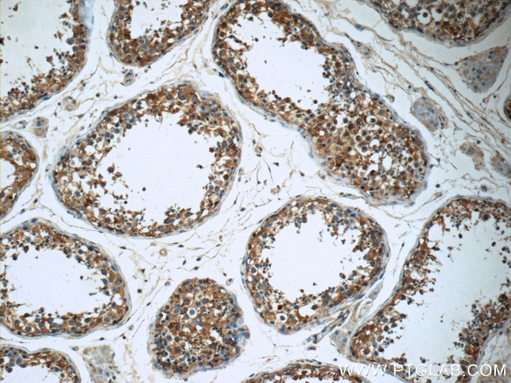 IHC staining of human testis using 17650-1-AP