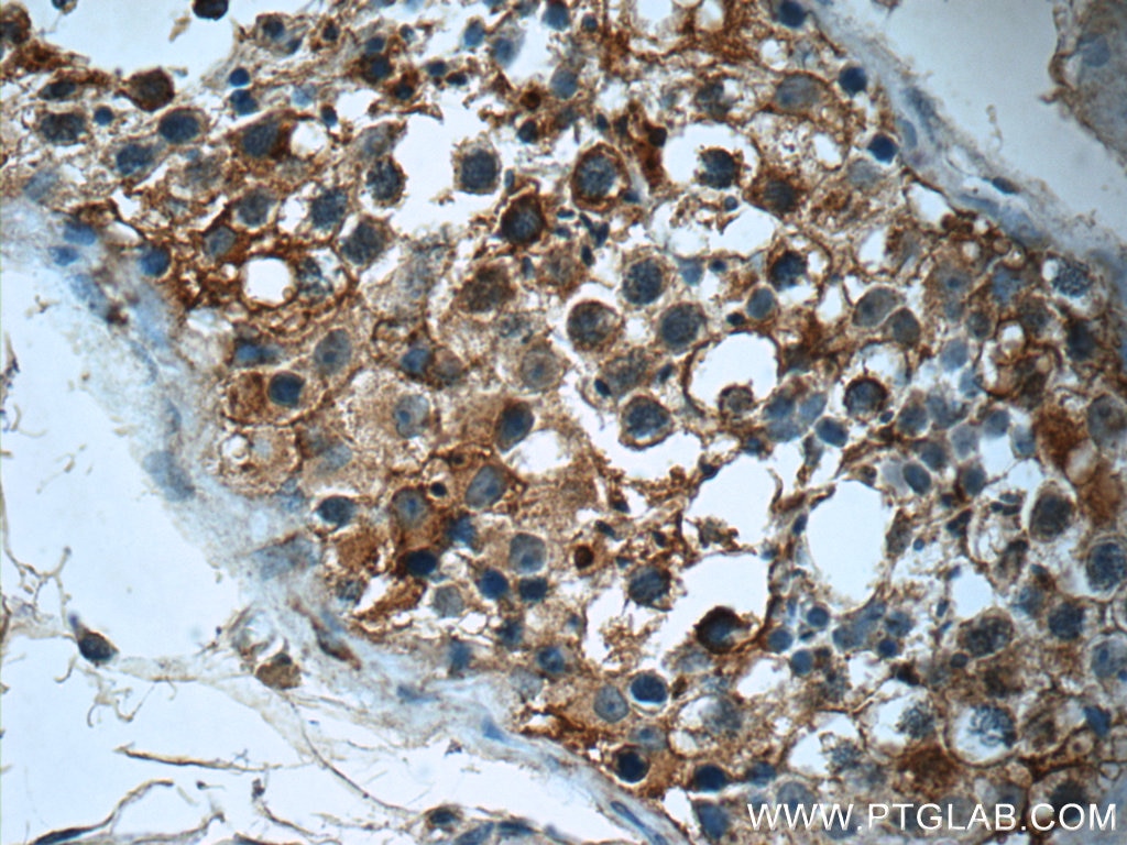 Immunohistochemistry (IHC) staining of human testis tissue using PAAF1 Polyclonal antibody (17650-1-AP)