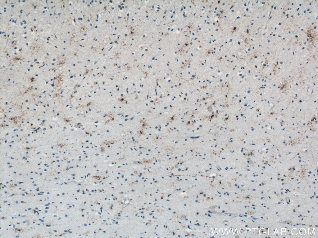 Immunohistochemistry (IHC) staining of human brain tissue using PAAF1 Polyclonal antibody (17650-1-AP)