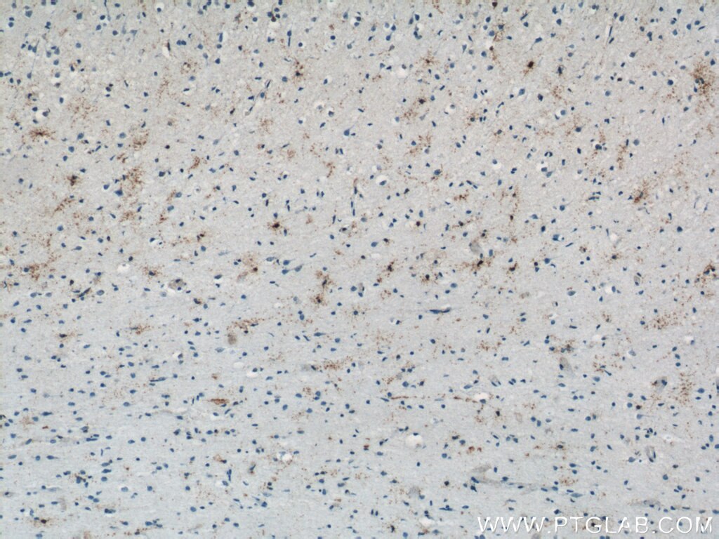 Immunohistochemistry (IHC) staining of human brain tissue using PAAF1 Polyclonal antibody (17650-1-AP)