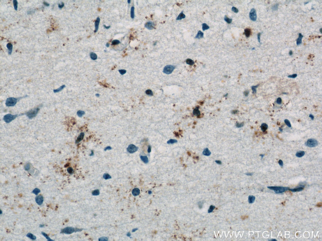Immunohistochemistry (IHC) staining of human brain tissue using PAAF1 Polyclonal antibody (17650-1-AP)