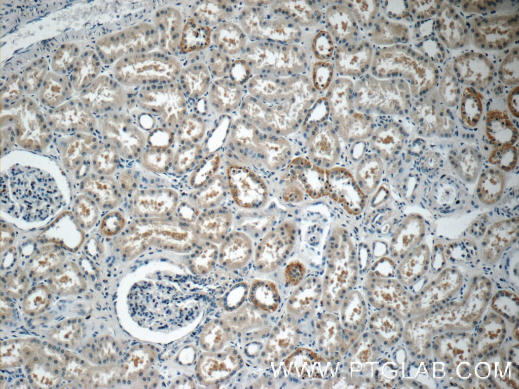 Immunohistochemistry (IHC) staining of human kidney tissue using PAAF1 Polyclonal antibody (17650-1-AP)