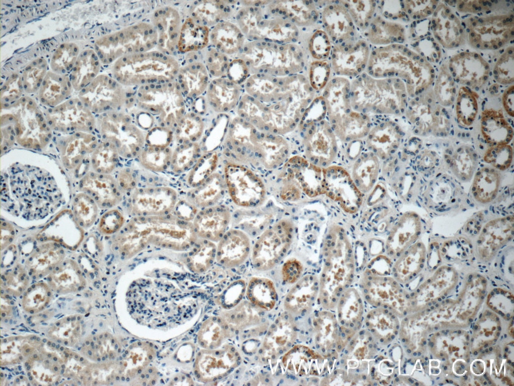 Immunohistochemistry (IHC) staining of human kidney tissue using PAAF1 Polyclonal antibody (17650-1-AP)
