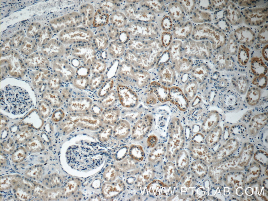 IHC staining of human kidney using 17650-1-AP