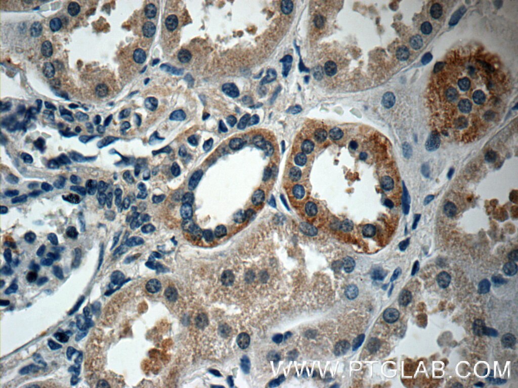 Immunohistochemistry (IHC) staining of human kidney tissue using PAAF1 Polyclonal antibody (17650-1-AP)