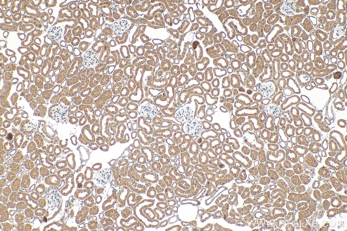 Immunohistochemistry (IHC) staining of mouse kidney tissue using PAAF1 Polyclonal antibody (17650-1-AP)