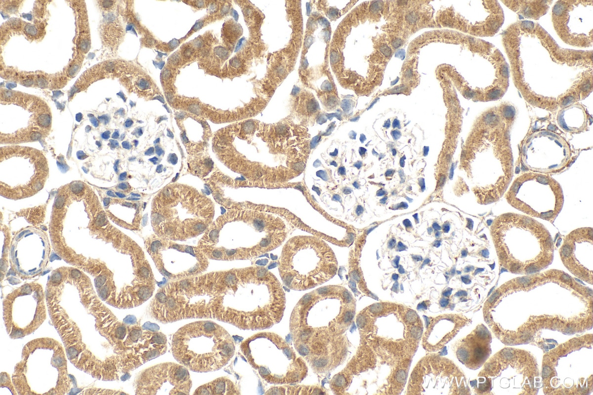 Immunohistochemistry (IHC) staining of mouse kidney tissue using PAAF1 Polyclonal antibody (17650-1-AP)