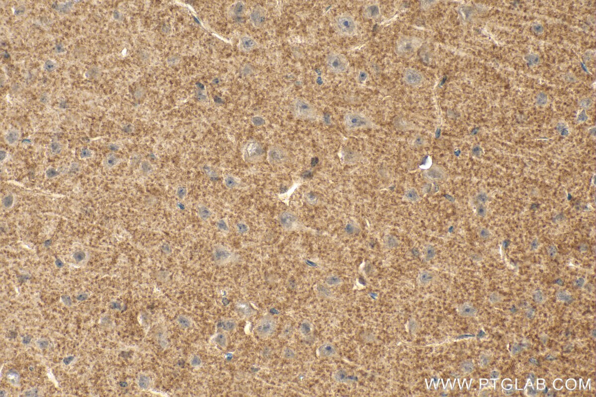 Immunohistochemistry (IHC) staining of mouse brain tissue using PAAF1 Polyclonal antibody (17650-1-AP)