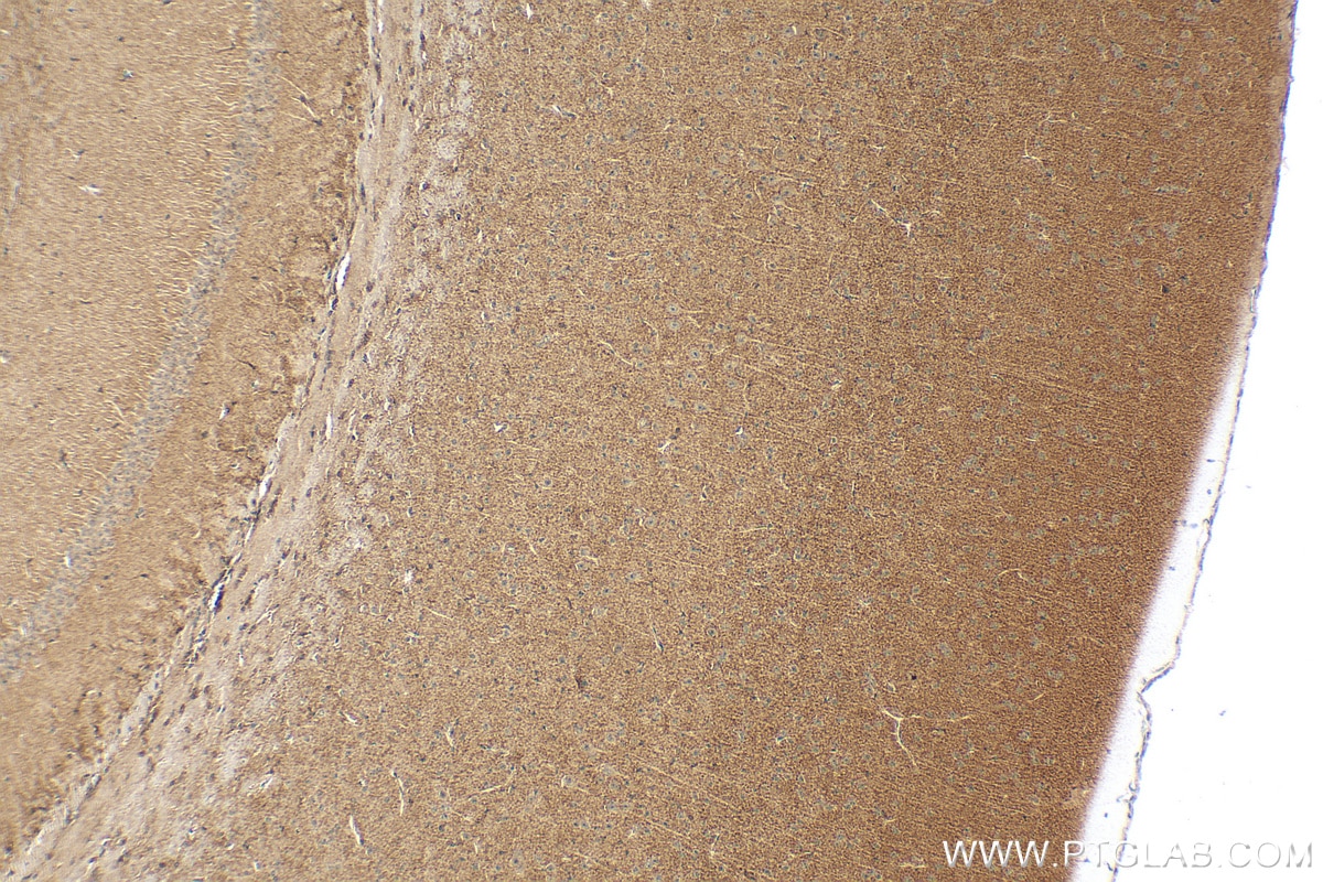 Immunohistochemistry (IHC) staining of mouse brain tissue using PAAF1 Polyclonal antibody (17650-1-AP)