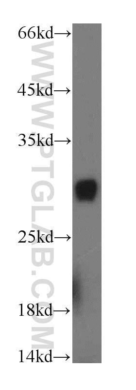 Western Blot (WB) analysis of mouse brain tissue using PAAF1 Polyclonal antibody (17650-1-AP)