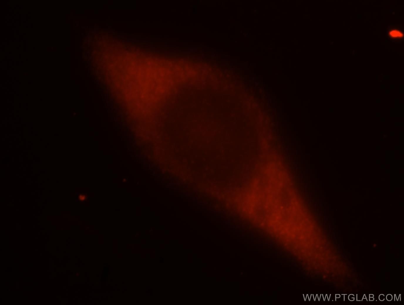 Immunofluorescence (IF) / fluorescent staining of MCF-7 cells using PABPC1,PABP Polyclonal antibody (10970-1-AP)