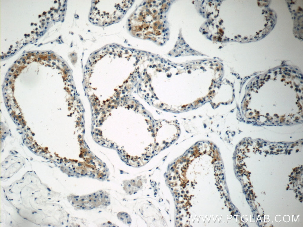 IHC staining of human testis using 10970-1-AP